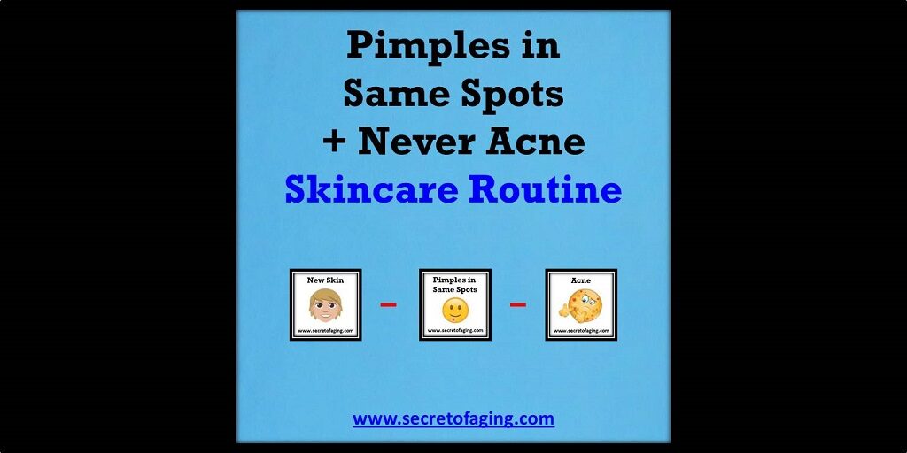 Pimples in Same Spots Plus Never Acne Routine